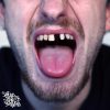 Res & DatKid (Split Prophets) – Comparisons